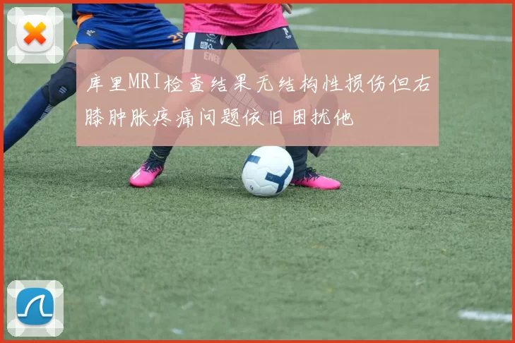 库里MRI检查结果无结构性损伤但右膝肿胀疼痛问题依旧困扰他